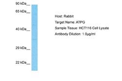 ATPG Antibody, Novus Biologicals 100 &mu;L | Buy Online | Novus Biologicals | Fisher Scientific